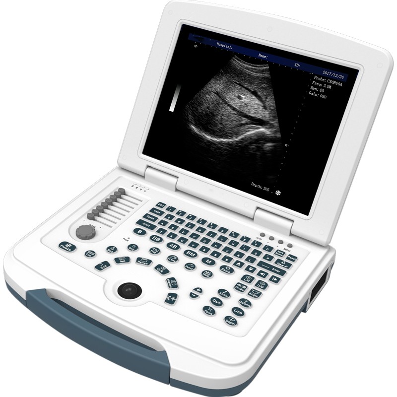 Laptop Ultrasound Scanner--ZSU580
